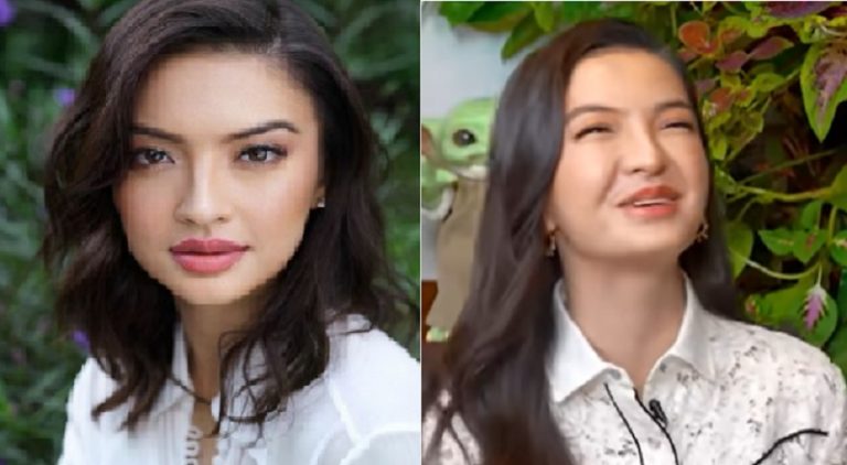 Meditasi dan Akupunktur Selamatkan Raline Shah dari Bell’s Palsy